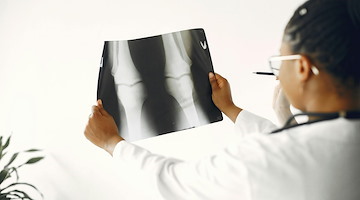 Salute, stamattina a Sorrento un convegno sull'osteoporosi